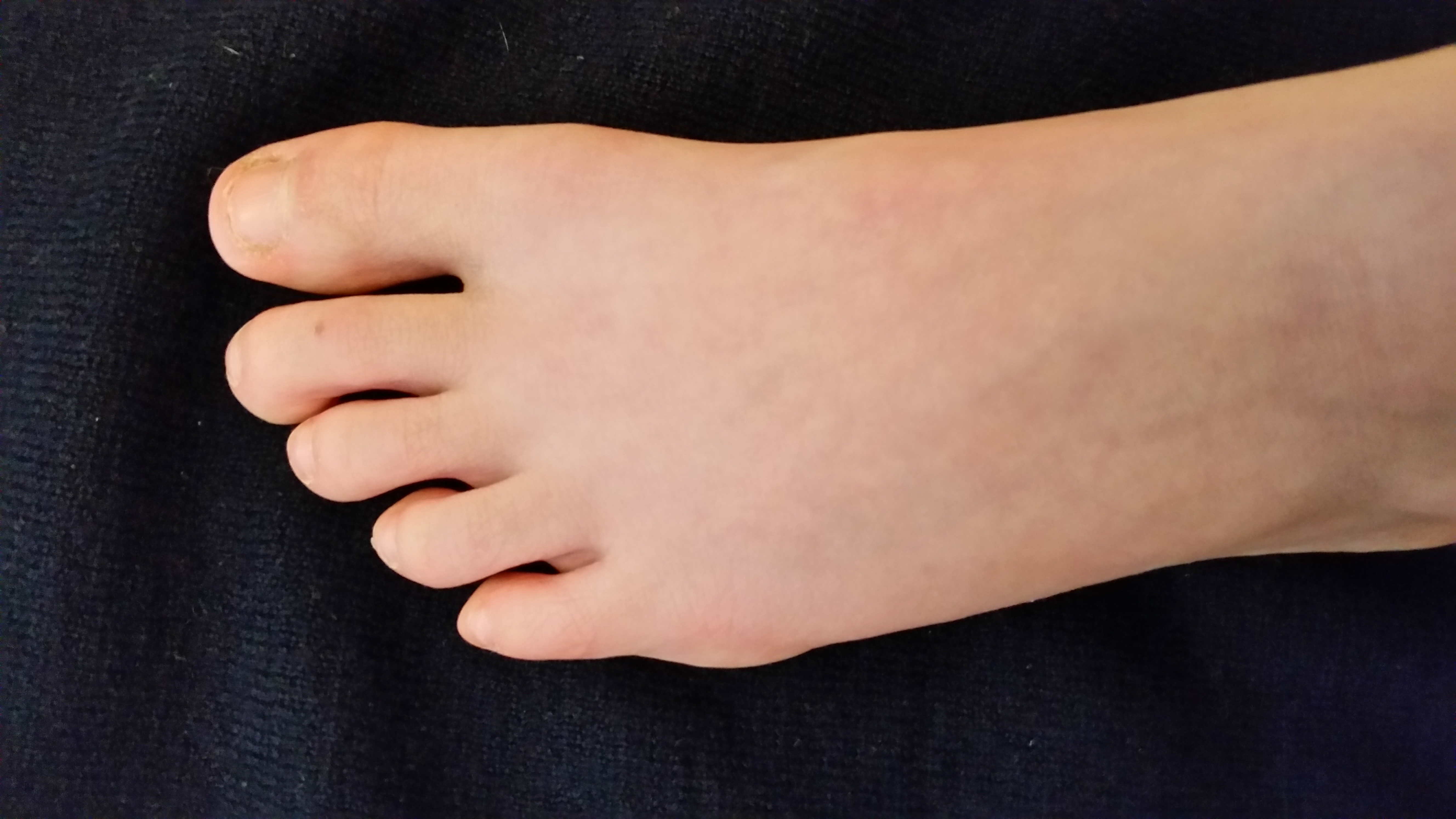 Autisme ADHD